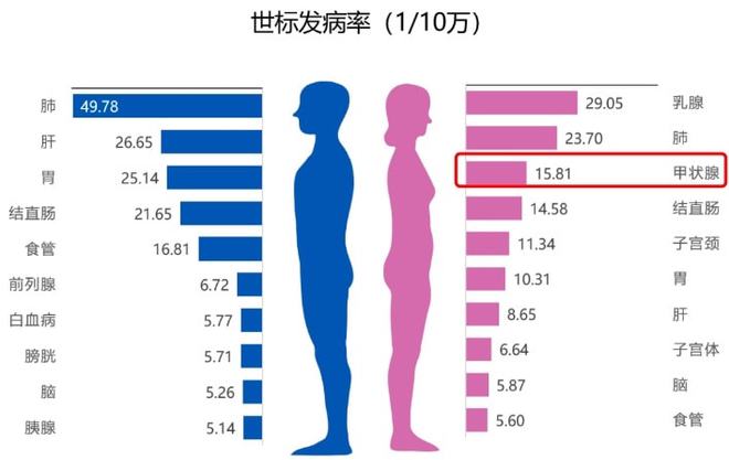 种癌症发生率显着降低的运动方案 运动抗击癌症 144 万人研究揭示13