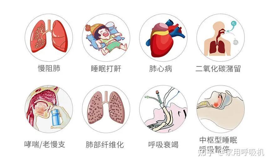 冬季慢阻肺高发 高危人群尽早筛查干预 世界慢阻肺日