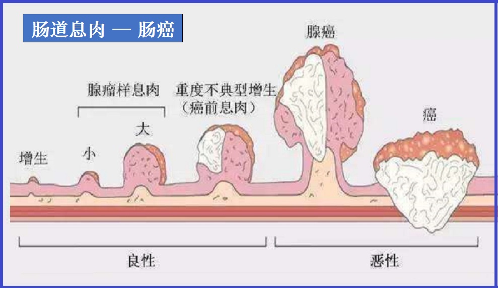 肠