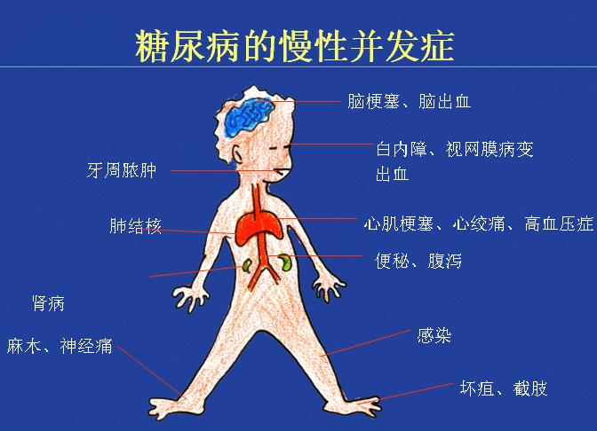 病友