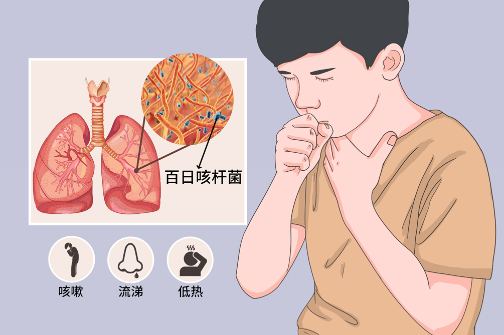 了解百日咳 北京疾控提醒您