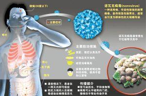 急性胃肠炎