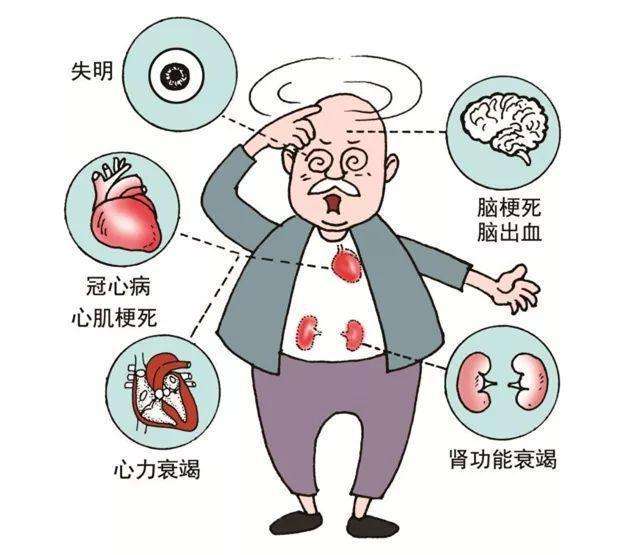 高血压等多种不适症状 耳尖放血 失眠 全方位缓解头痛