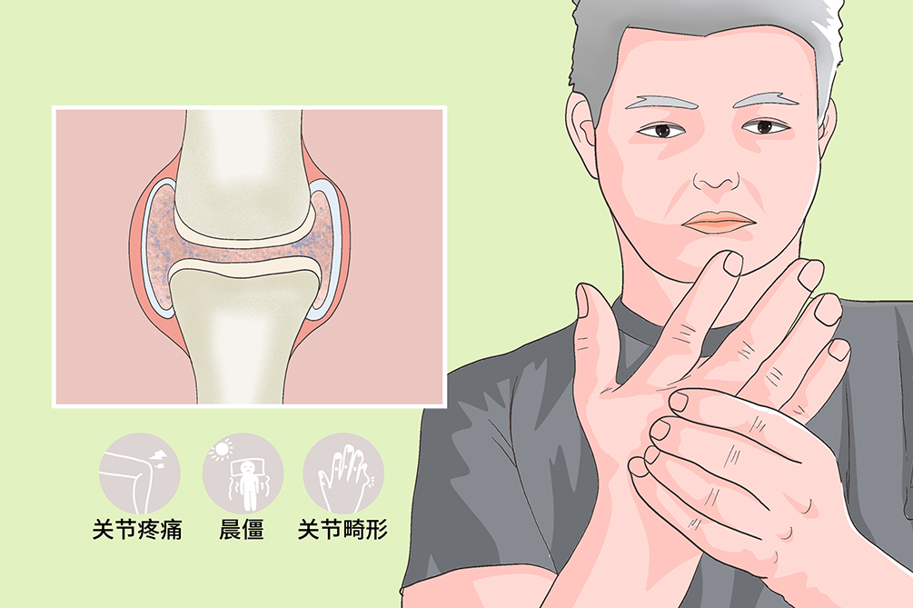 认为关节炎是衰老的必然结果