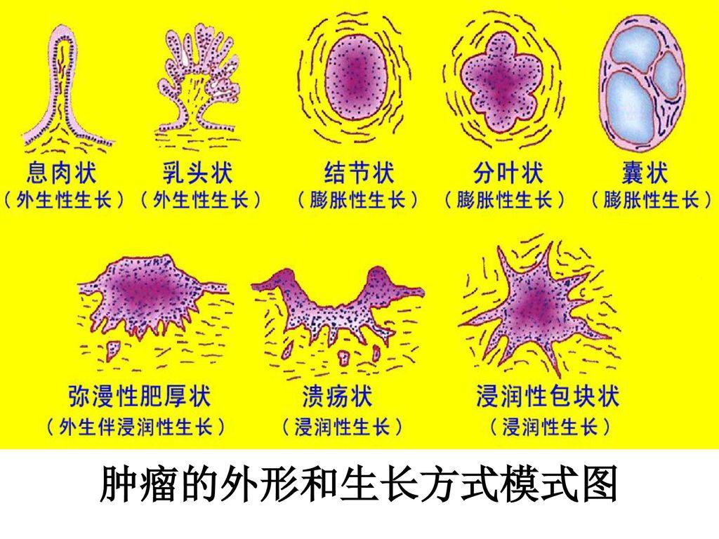 病情