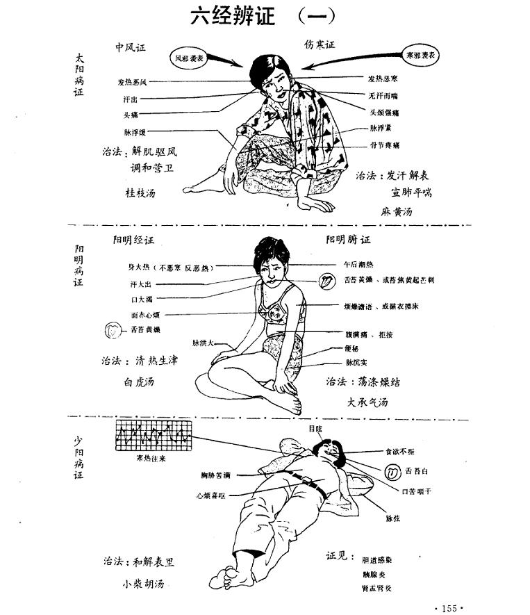 六大症状和易患因素揭秘 警惕十二指肠溃疡