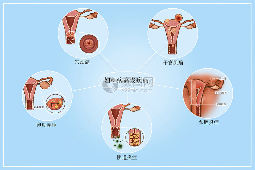 远离妇科疾病！ 呵护子宫健康的6种女性必吃食物