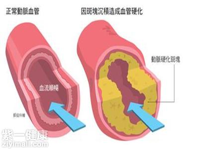 摄入量