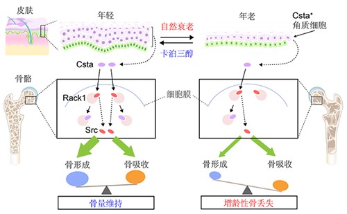 绝经后夫妻生活的3大困扰 不要羞于开口