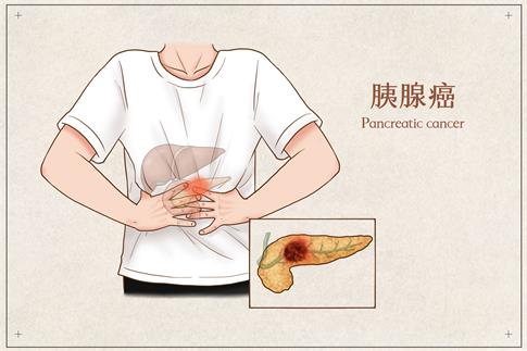 警惕胰腺炎！9类人群预防必读 恶心 腹痛 发热