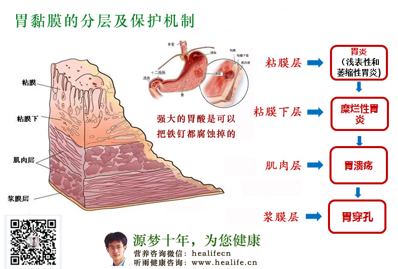 了解保护胃部健康的秘诀 保胃健康